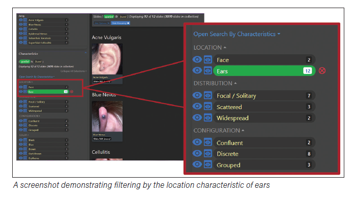 A screenshot demonstrating filtering by the location characteristic of ears