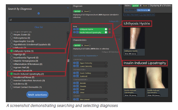 A screenshot demonstrating searching and selecting diagnoses